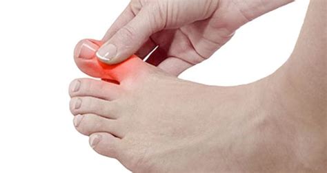 toe hurting when walking
